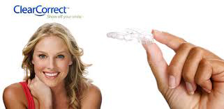 clear correct teeth braces woodbridge va